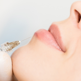 Relleno de Labios